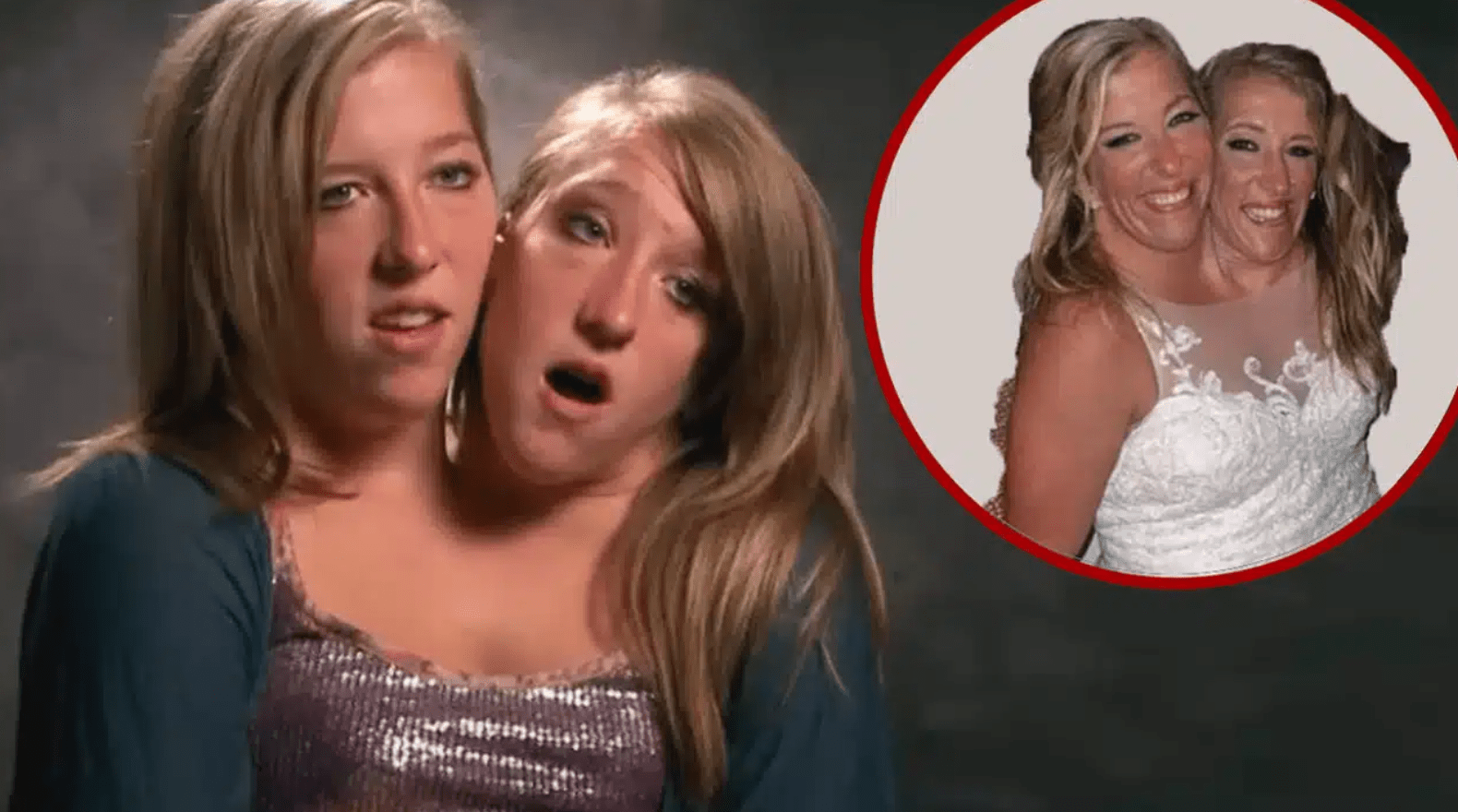 Is it true that Brittany and Abby Hensel, the conjoined twins, have gotten married?