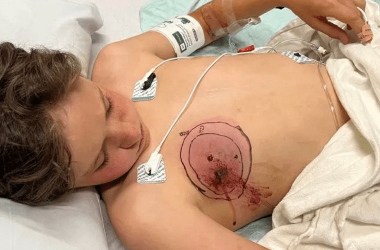 ‘He’s a Tough Boy,’ says the mother of an 11-year-old boy who was bitten by a rattlesnake.