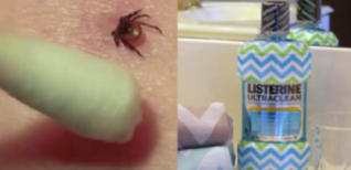 Listerine Isn’t Just A Mouthwash – Here Are 15 Incredible Uses Every Woman Should Be Aware Of