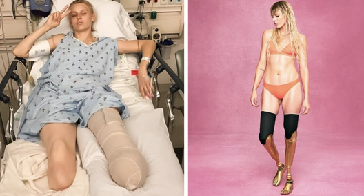 Lauren Wasser, author of “I Lost Both of My Legs Because of a Tampon,” defied the odds to become a well-known model.