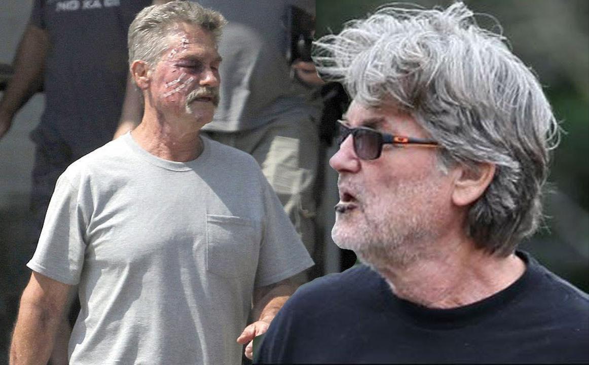 Kurt Russell had what medical conditions?