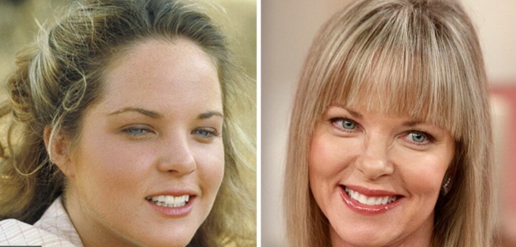 What became of Melissa Sue Anderson? See what she’s been up to.