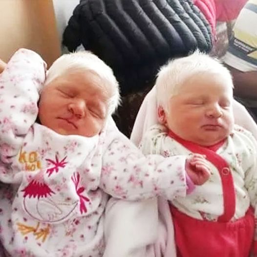 The Beautiful Albino Twins: Catalina and Virginia