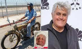 Jay Leno’s Resilience: Bouncing Back from Injury