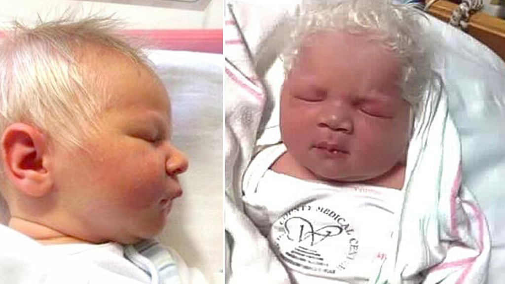 Baby boy born with unique snow-white hair captures hearts