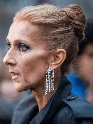 Céline Dion’s Battle with Stiff-Person Syndrome