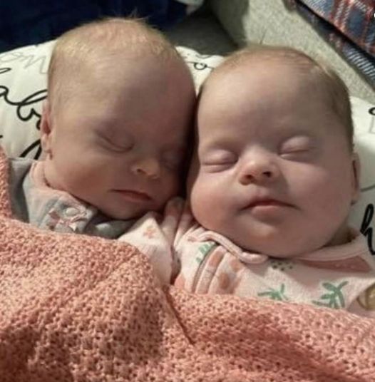 A Beautiful Journey: Twins with Down Syndrome