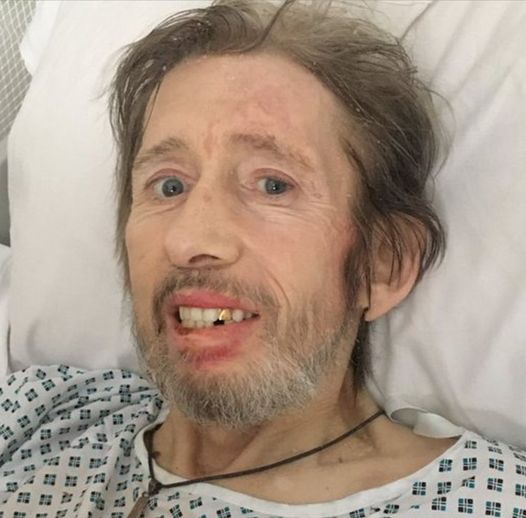 Remembering Shane MacGowan: A Musical Legend