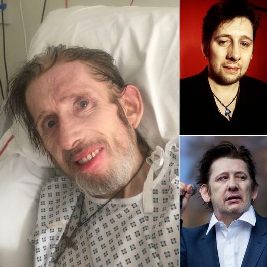 Remembering Shane MacGowan: The Iconic Voice of The Pogues