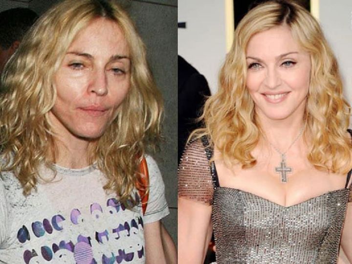 Madonna’s Ever-Changing Appearance at the Grammys Sparks Controversy