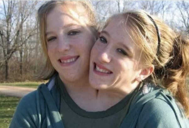 Abby and Brittany: Conjoined Twins Tie the Knot with the Same Man!