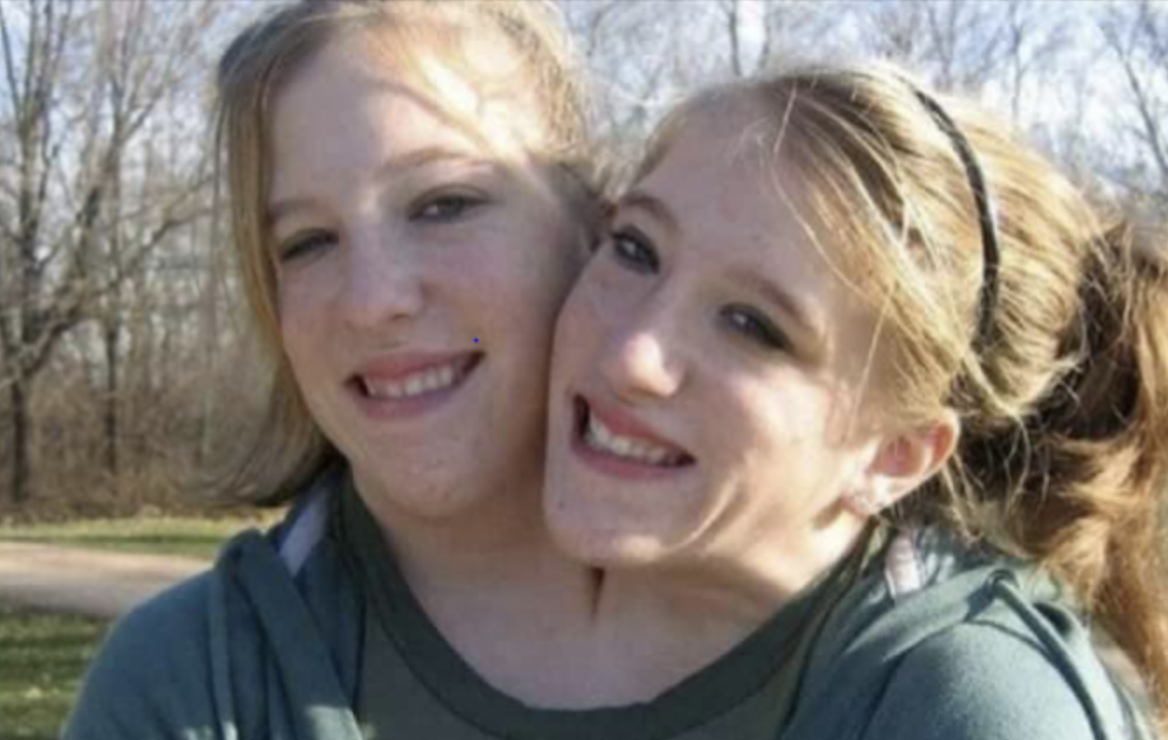 Abby and Brittany: Conjoined Twins Marry the Love of Their Life!